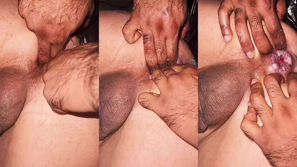 уэсли вентура - пролапс