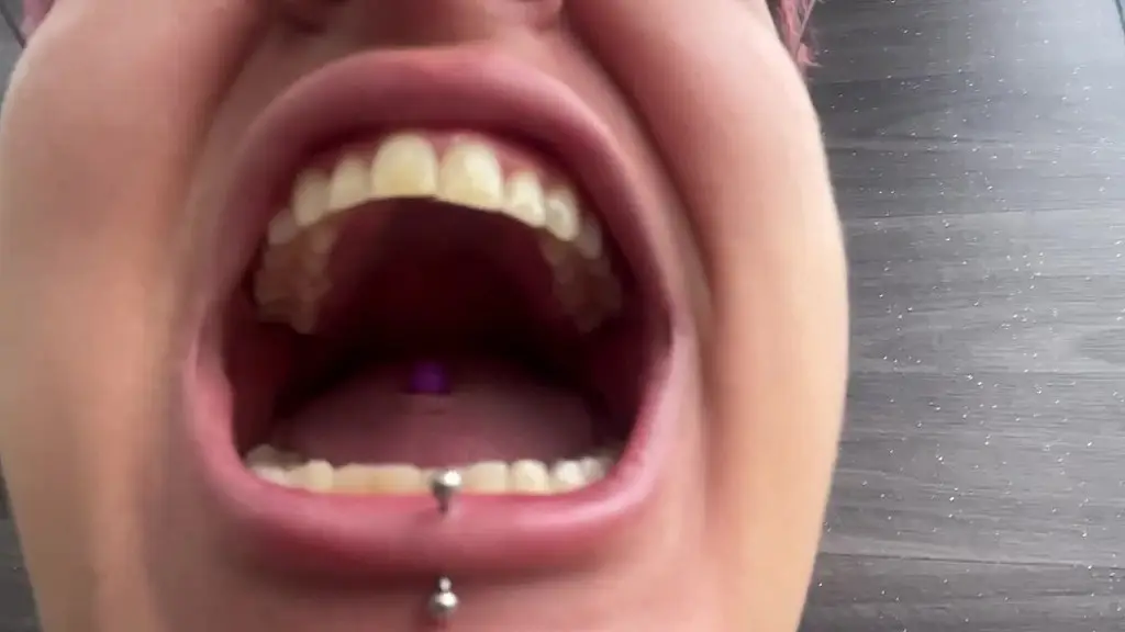 teeth check-up on the bus