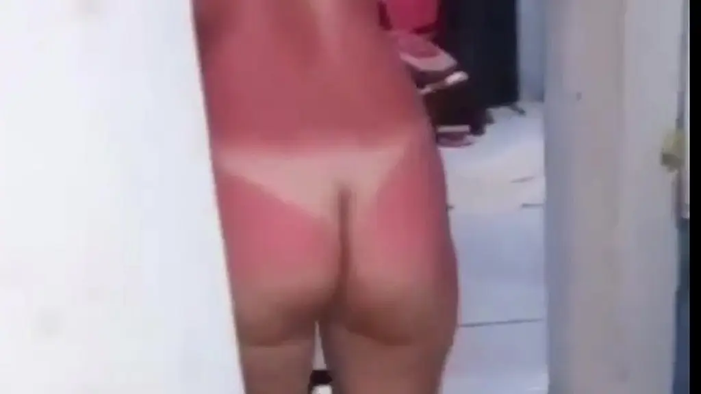 chegou da praia, deu a bundinha e saiu mancando