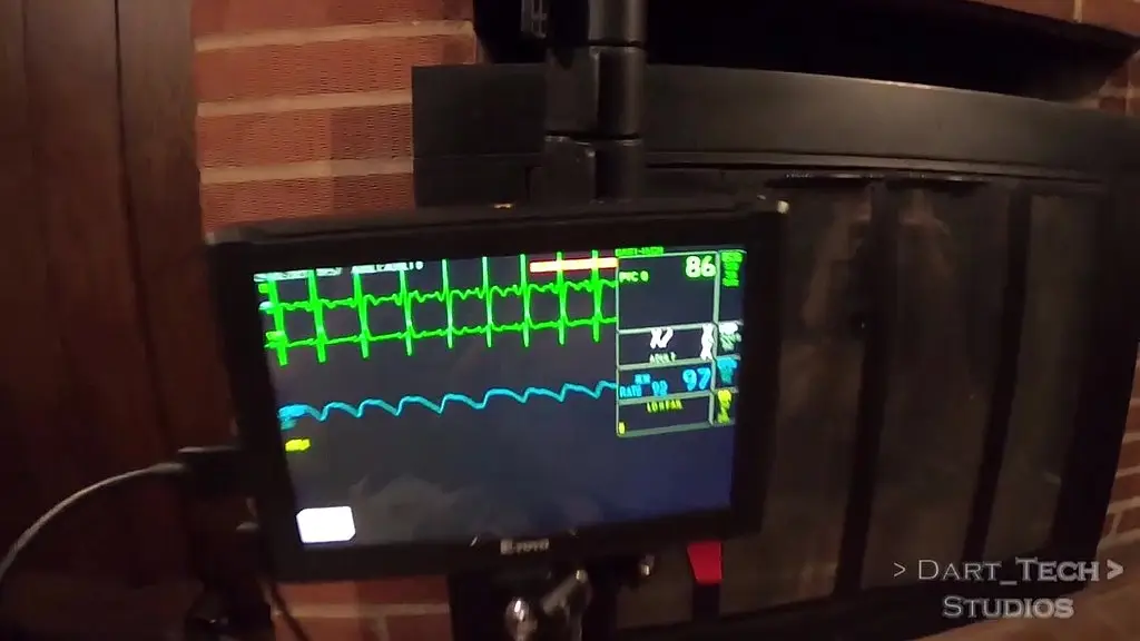 topless vitals monitor adventures with dart