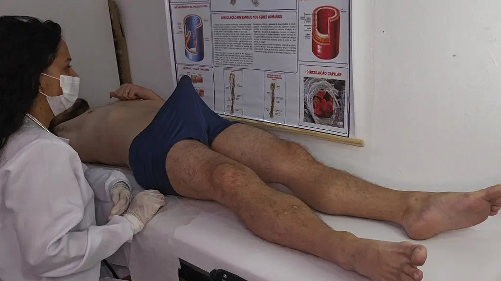 nurse observes patient s erection