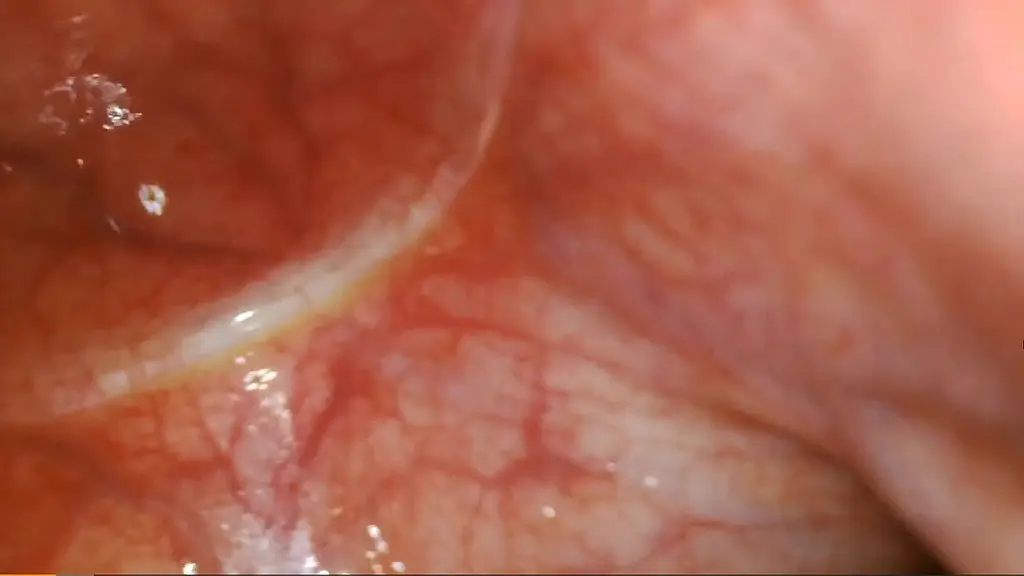 internal pov: micro-camera journey inside my body